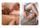 Pain Management Acupuncture in NYC | Back, Neck & Sciatica Relief