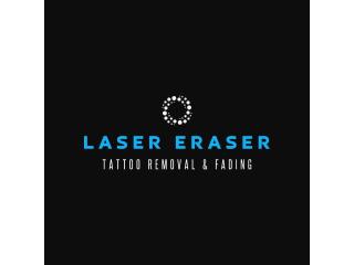 Best Options For Tattoo Removal Nj Services Near You