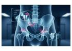 Hip Pain Relief Experts | Trusted Orthopedic Care