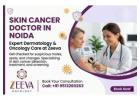 Skin Cancer Doctor In Noida | Trusted Cancer Specialist