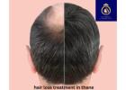 Top Hair Loss Treatment in Thane by DNA Royal Experts.