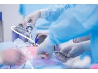 Top Doctor for Gallbladder Stone Surgery Kolkata