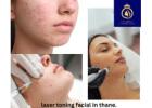DNA Royal – Best Laser Toning Facial in Thane for Radiant Skin.