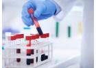 Reliable Blood Test & Pathology Clinic in Noida | Accurate Lab Services