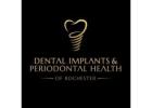 Dental Implants & Periodontal Health