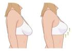 Breast Reshaping Surgery By Harley Surgical Group In UK