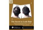 Hair loss treatment in Baner- The Aesthetic Hub