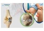 Cost of Partial ACL Tear Treatment in Sarjapur Road, Bangalore - Dr.Nataraj H M
