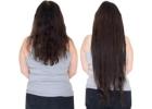 Top Hair Patch Services in Ghaziabad for Instant Hair Transformation