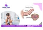 Expert Penile Curvature Treatment for Better Performance -Orchidz Health