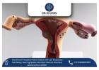 Say Goodbye to Fibroid Symptoms with Expert Care