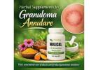 Natural Supplements for Granuloma Annulare Skin Lesions fast