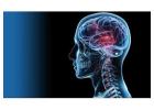 Neurosciences Brain Spine Surgery in Delhi