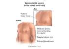 Male Breast Reduction London By Harley Surgical Group Clinic