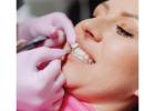 Transform Your Smile with Cosmetic Dentistry in Perris