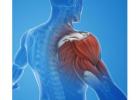 Effective Shoulder Impingement Treatment in Gurgaon – Expert Pain Relief & Recovery