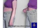 Achieve Your Dream Body with DNA Royal – Best Weight Loss Clinic in Thane.