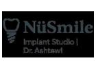 NuSmile Implant Studio: Beverly Chicago’s Destination for Advanced Dental Implants