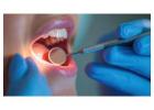 Best Oral Cancer Doctor in Delhi for Advanced Treatment