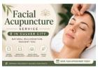 Facial Acupuncture Service in Culver City 