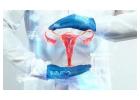 Endometrial Cancer Hospital in Delhi
