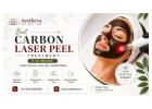 Best Carbon Laser Peel Treatment in Indore – Aestheva