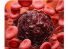 Hematologist Doctor in Hyderabad