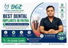 Best Dental Implants in Patna for a Confident Smile