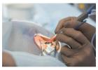 Can I Live With Cataracts Without Surgery?