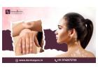 Personalized Advanced Vitiligo Treatment in Bangalore - Dermaqure