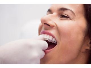Roslyn’s Trusted Dental Care for Confident Smiles