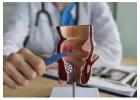 Trusted Fistula Surgeon for Advanced Treatment Kolkata  