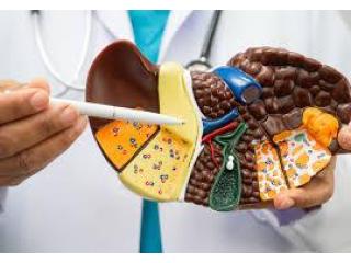 Trusted Liver Cirrhosis Treatment in Ahmedabad