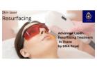 Get Glowing Skin with Laser Resurfacing Treatment in Thane | DNA Royal.