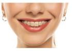 Removable Teeth Braces Dombivli for Perfect Smile
