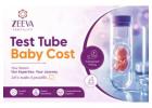 Test Tube Baby Cost in Noida: Complete IVF Pricing Guide