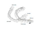 Invisalign Surrey - Clear Aligners for Teens & Comfortable Care
