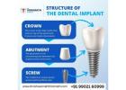 Costs of Dental Implants in Bangalore | Consult Dr. Vishwannath Hiremath
