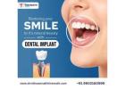 Full Mouth Dental Implant Procedure in Bangalore | Dr. Vishwannath Hiremath