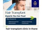 Affordable Hair Transplant Clinic in Thane with Expert Care | DNA Royal.