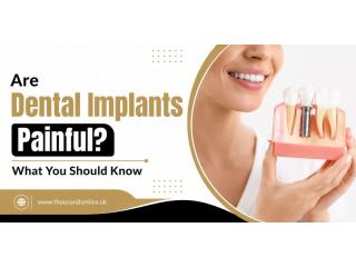 Are Dental Implants Painful? What You Should Know