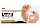 Are Dental Implants Painful? What You Should Know