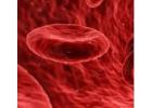 Hematologist in Hyderabad