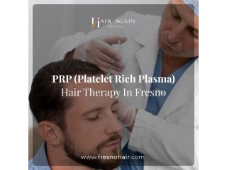 Platelet Rich Plasma Hair Therapy in Fresno CA