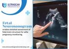 Ultrascan Diagnostics for Fetal Neurosonogram in Indore City