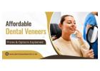 Affordable Dental Veneers – Prices & Options Explained