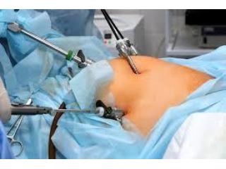 Laparoscopic Hernia Surgery in Kolkata