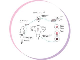 Advanced Mini IVF Treatment at Trusted IVF Center