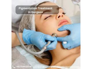 Pigmentation Treatment in Gurgaon for Clear & Even Skin