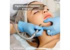 Pigmentation Treatment in Gurgaon for Clear & Even Skin